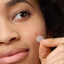 A Smarter Solution to Blemishes: Skip the Pimple Popping